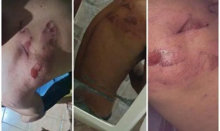 Patrões invadem alojamento e atacam trabalhadores com facão em MT